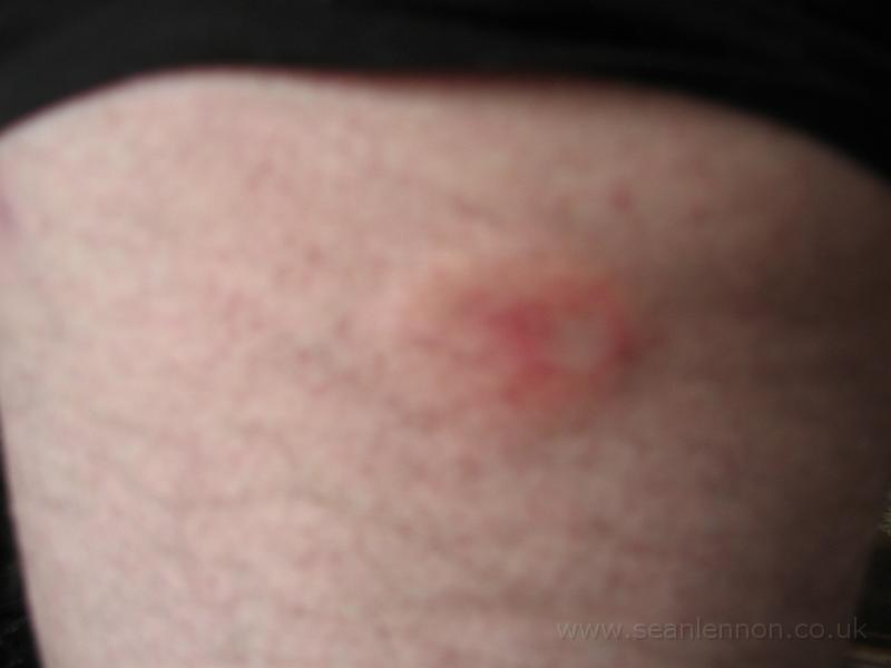 23 March 2005 - Sean's arse 042.jpg